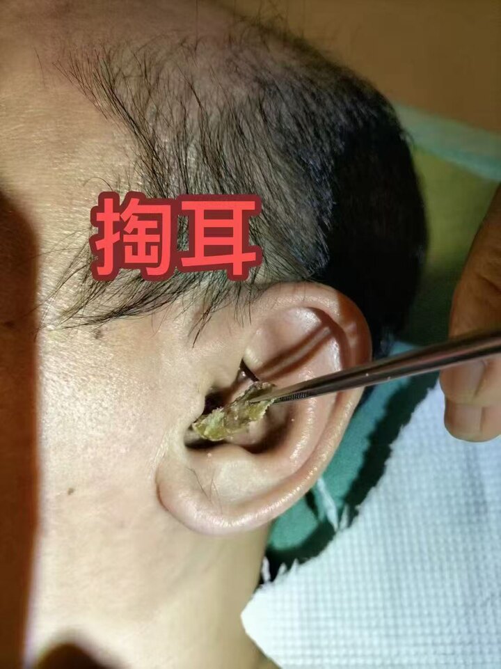 掏耳图.jpg
